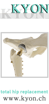 Referral, Greenmount, Veterinary, vet, disc, disease, prolapse, Orthopaedic, orthopedic, specialist, clinic, fractures, joint, surgery, arthroscopy, endoscopy, spinal, northern, ireland, OCD, FCP, TPO, cruciate ligament, tplo, hip, dysplasia, dislocation, medial, patellar, luxation, broken, leg, wobbler, caudal cervical spondylopathy, lumbar, paralysis,ACL, anterior cruciate ligament rupture, dislocated, dislocation, plating, pinning, external fixator, triple pelvic osteotomy, portadown, co armagh northern ireland, www.vetortho.co.uk, www.vetclinic.co.uk