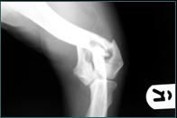 Referral, Greenmount, Veterinary, vet, disc, disease, prolapse, Orthopaedic, orthopedic, specialist, clinic, fractures, joint, surgery, arthroscopy, endoscopy, spinal, northern, ireland, OCD, FCP, TPO, cruciate ligament, tplo, hip, dysplasia, dislocation, medial, patellar, luxation, broken, leg, wobbler, caudal cervical spondylopathy, lumbar, paralysis,ACL, anterior cruciate ligament rupture, dislocated, dislocation, plating, pinning, external fixator, triple pelvic osteotomy, portadown, co armagh northern ireland, www.vetortho.co.uk, www.vetclinic.co.uk