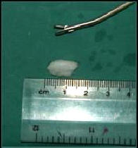 Referral, Greenmount, Veterinary, vet, disc, disease, prolapse, Orthopaedic, orthopedic, specialist, clinic, fractures, joint, surgery, arthroscopy, endoscopy, spinal, northern, ireland, OCD, FCP, TPO, cruciate ligament, tplo, hip, dysplasia, dislocation, medial, patellar, luxation, broken, leg, wobbler, caudal cervical spondylopathy, lumbar, paralysis,ACL, anterior cruciate ligament rupture, dislocated, dislocation, plating, pinning, external fixator, triple pelvic osteotomy, portadown, co armagh northern ireland, www.vetortho.co.uk, www.vetclinic.co.uk