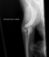 Referral, Greenmount, Veterinary, vet, disc, disease, prolapse, Orthopaedic, orthopedic, specialist, clinic, fractures, joint, surgery, arthroscopy, endoscopy, spinal, northern, ireland, OCD, FCP, TPO, cruciate ligament, tplo, hip, dysplasia, dislocation, medial, patellar, luxation, broken, leg, wobbler, caudal cervical spondylopathy, lumbar, paralysis,ACL, anterior cruciate ligament rupture, dislocated, dislocation, plating, pinning, external fixator, triple pelvic osteotomy, portadown, co armagh northern ireland, www.vetortho.co.uk, www.vetclinic.co.uk