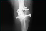 Referral, Greenmount, Veterinary, vet, disc, disease, prolapse, Orthopaedic, orthopedic, specialist, clinic, fractures, joint, surgery, arthroscopy, endoscopy, spinal, northern, ireland, OCD, FCP, TPO, cruciate ligament, tplo, hip, dysplasia, dislocation, medial, patellar, luxation, broken, leg, wobbler, caudal cervical spondylopathy, lumbar, paralysis,ACL, anterior cruciate ligament rupture, dislocated, dislocation, plating, pinning, external fixator, triple pelvic osteotomy, portadown, co armagh northern ireland, www.vetortho.co.uk, www.vetclinic.co.uk