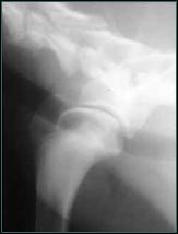 Referral, Greenmount, Veterinary, vet, disc, disease, prolapse, Orthopaedic, orthopedic, specialist, clinic, fractures, joint, surgery, arthroscopy, endoscopy, spinal, northern, ireland, OCD, FCP, TPO, cruciate ligament, tplo, hip, dysplasia, dislocation, medial, patellar, luxation, broken, leg, wobbler, caudal cervical spondylopathy, lumbar, paralysis,ACL, anterior cruciate ligament rupture, dislocated, dislocation, plating, pinning, external fixator, triple pelvic osteotomy, portadown, co armagh northern ireland, www.vetortho.co.uk, www.vetclinic.co.uk