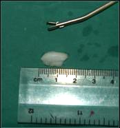 Referral, Greenmount, Veterinary, vet, disc, disease, prolapse, Orthopaedic, orthopedic, specialist, clinic, fractures, joint, surgery, arthroscopy, endoscopy, spinal, northern, ireland, OCD, FCP, TPO, cruciate ligament, tplo, hip, dysplasia, dislocation, medial, patellar, luxation, broken, leg, wobbler, caudal cervical spondylopathy, lumbar, paralysis,ACL, anterior cruciate ligament rupture, dislocated, dislocation, plating, pinning, external fixator, triple pelvic osteotomy, portadown, co armagh northern ireland, www.vetortho.co.uk, www.vetclinic.co.uk