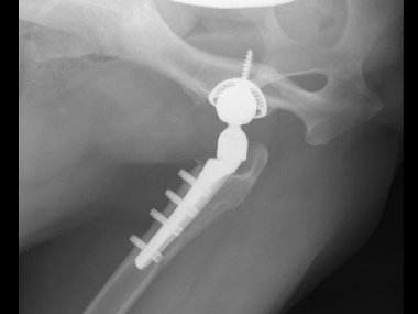 hip replacement surgery for dogs