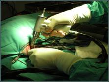 Referral, Greenmount, Veterinary, vet, disc, disease, prolapse, Orthopaedic, orthopedic, specialist, clinic, fractures, joint, surgery, arthroscopy, endoscopy, spinal, northern, ireland, OCD, FCP, TPO, cruciate ligament, tplo, hip, dysplasia, dislocation, medial, patellar, luxation, broken, leg, wobbler, caudal cervical spondylopathy, lumbar, paralysis,ACL, anterior cruciate ligament rupture, dislocated, dislocation, plating, pinning, external fixator, triple pelvic osteotomy, portadown, co armagh northern ireland, www.vetortho.co.uk, www.vetclinic.co.uk