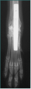 Referral, Greenmount, Veterinary, vet, disc, disease, prolapse, Orthopaedic, orthopedic, specialist, clinic, fractures, joint, surgery, arthroscopy, endoscopy, spinal, northern, ireland, OCD, FCP, TPO, cruciate ligament, tplo, hip, dysplasia, dislocation, medial, patellar, luxation, broken, leg, wobbler, caudal cervical spondylopathy, lumbar, paralysis,ACL, anterior cruciate ligament rupture, dislocated, dislocation, plating, pinning, external fixator, triple pelvic osteotomy, portadown, co armagh northern ireland, www.vetortho.co.uk, www.vetclinic.co.uk