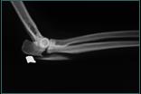 Referral, Greenmount, Veterinary, vet, disc, disease, prolapse, Orthopaedic, orthopedic, specialist, clinic, fractures, joint, surgery, arthroscopy, endoscopy, spinal, northern, ireland, OCD, FCP, TPO, cruciate ligament, tplo, hip, dysplasia, dislocation, medial, patellar, luxation, broken, leg, wobbler, caudal cervical spondylopathy, lumbar, paralysis,ACL, anterior cruciate ligament rupture, dislocated, dislocation, plating, pinning, external fixator, triple pelvic osteotomy, portadown, co armagh northern ireland, www.vetortho.co.uk, www.vetclinic.co.uk